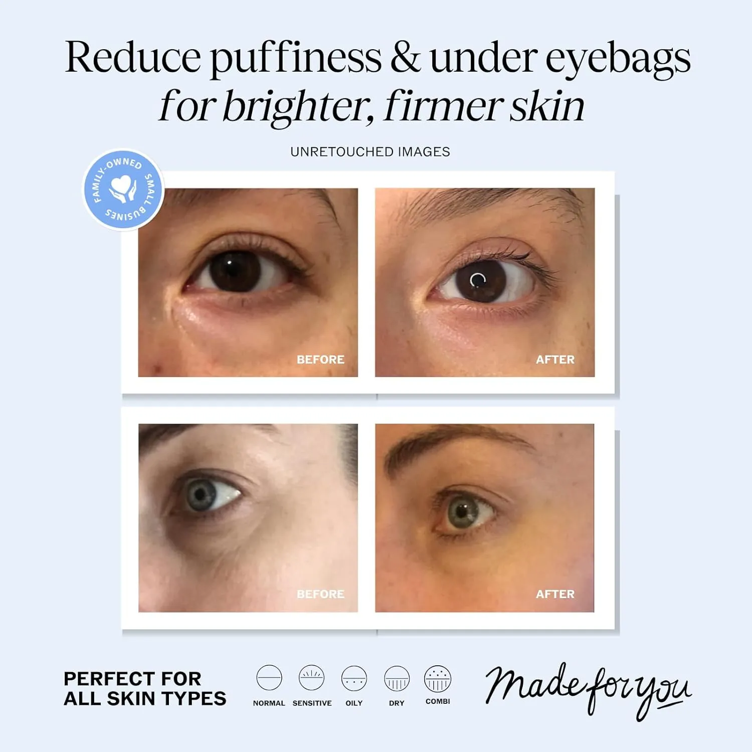 LilyAna Naturals Eye Cream for Dark Circles and Puffiness, Anti Aging Under Eye Cream for Wrinkles and Bags helps Improve Dryness; for Sensitive Skin (Bottle, 1.0 Ounce (Pack of 1))