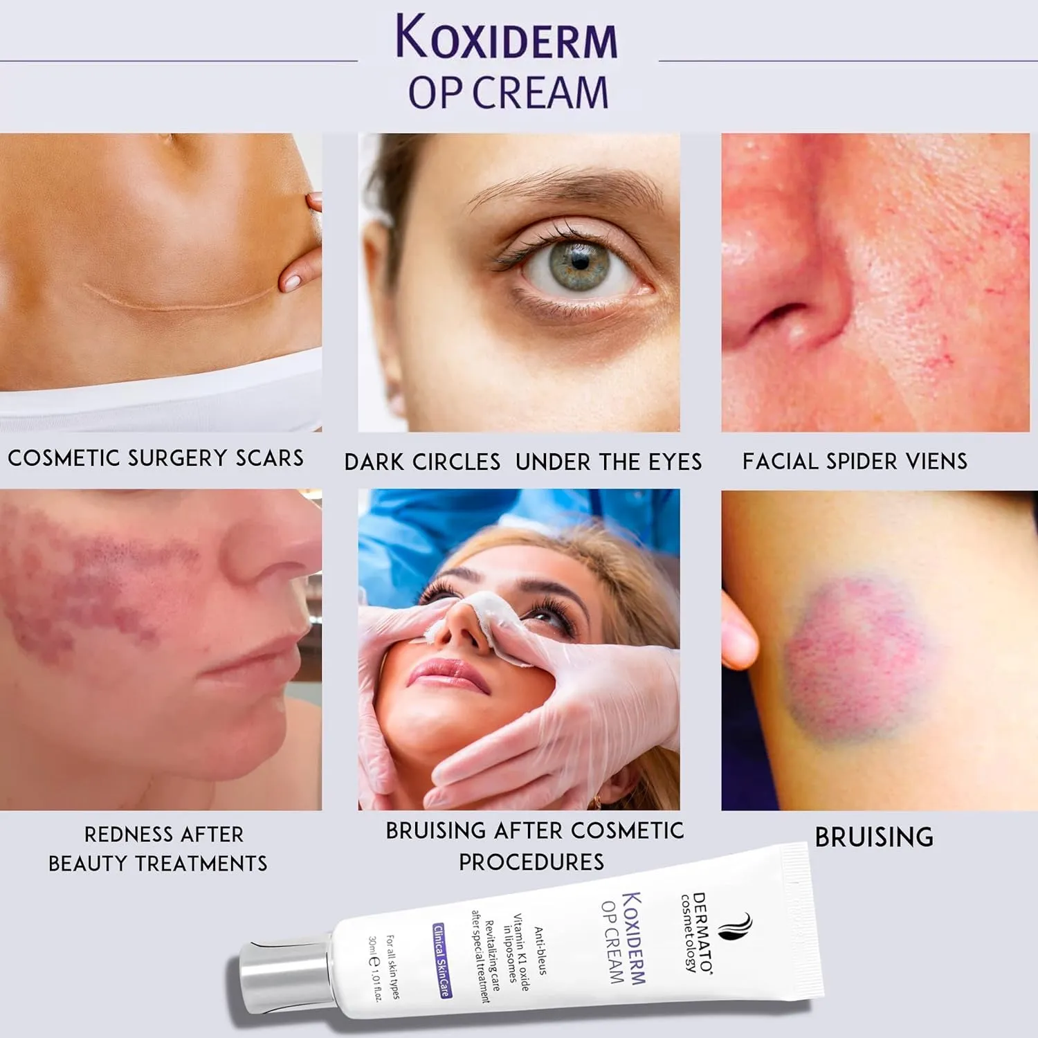 Vitamin K1 Oxiderm Cream Minimizing Appearance of Old and New Scars, Dark Eye Circles, Bruises, Varicose Veins, Purpura and Redness 1.01Oz (2 BOXES)